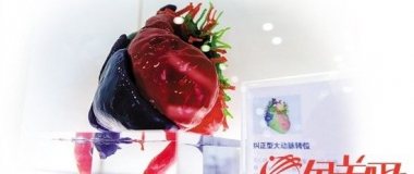 广州医生3D打印一颗心 救回2岁宝宝一条命 