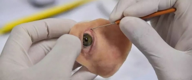 巴西妇患癌失右眼 3D打印人造眼助建新面孔